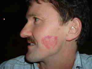 vergr&ouml;&szlig;ern durch Klick auf Bild (421k download)